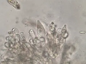 Cystiden op steel.webp